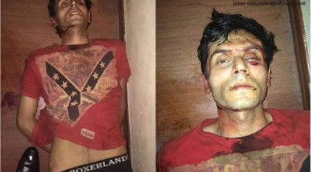 Nazirlik Yunis Səfərovun necə xəsarət aldığını açıqladı 