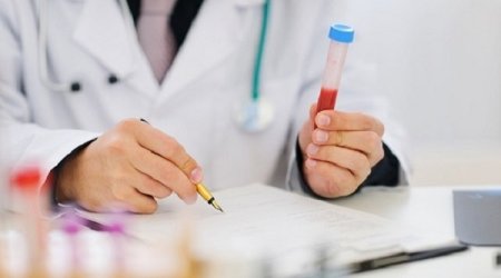 ƏHALİYƏ XƏBƏRDARLIQ - Yoluxucu xəstəlik yayılıb