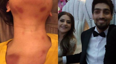 Bakıda jurnalist hamilə arvadını küçədə döyüb - FOTOLAR