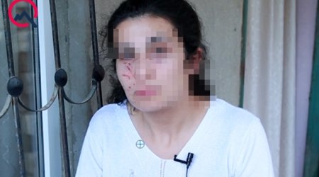 Bakıda zorlanmadan son anda qurtarılan qadın danışdı - VIDEO