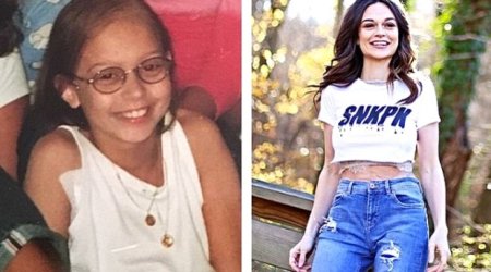 11 yaşında ayağı kəsilən qız böyüyüb məşhur model oldu – Fotolar