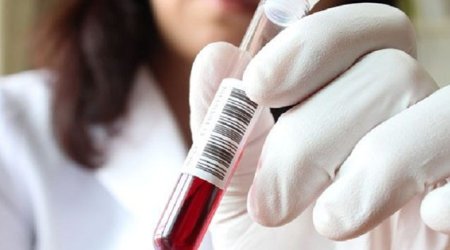 Daha bir məşhur idmançımız yarışlardan kənarlaşdırıldı