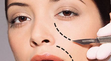 Почему в Азербайджане растет популярность пластических операций? – ВИДЕО