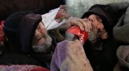 Bakıda gözləri görməyən kimsəsiz qocanın üzünü siçovullar yedi - VİDEO
