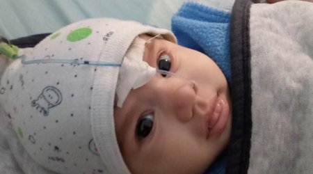 Azərbaycanda həkimin səhv qan köçürməsi nəticəsində 3 aylıq körpə öldü -İDDİA