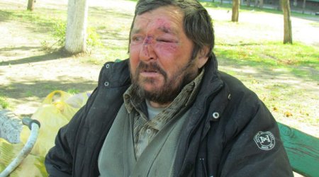 Üç ali təhsili olsa da, səfil həyatı yaşayan həmyerlimiz vətənə qaytarıldı - VİDEO+FOTOLAR