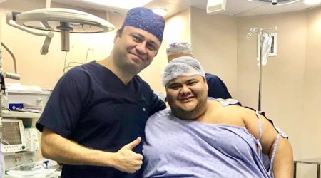 Azərbaycanlı həkim 203 kiloluq gəncin görkəmini dəyişdi - FOTOLAR