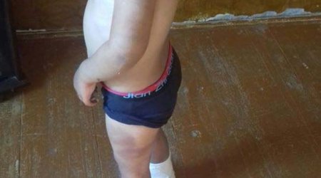 Azərbaycanda uşaqlara işgəncə - DƏHŞƏTLİ FAKTLAR, FOTOLAR