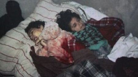 Erməni vəhşiliyini sübut edən dəhşətli – FOTOLAR (18+)