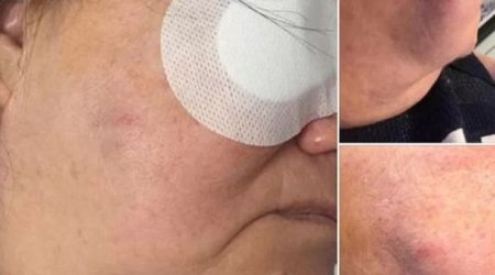 Bakıda həkim əməliyyat etdiyi qadına yumruq vurdu: “Əsəbi idim, hər kəsdə belə ola bilər” - FOTO