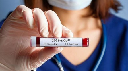 Koronavirusa qarşı dərman sınaqları ölümlə nəticələndi - testlər dayandırıldı