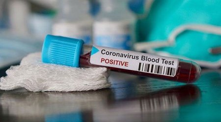 Koronavirusla bağlı araşdırmalara başlanıldı