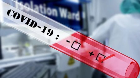 ABŞ koronavirusa qarşı peyvəndin hazırlanacağı vaxtı açıqladı