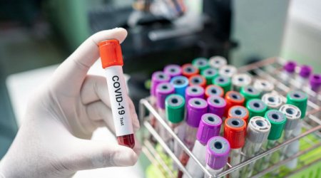 Rusiyada koronavirusa yoluxanların sayı açıqlandı