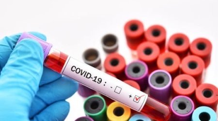 SON DƏQİQƏ: Jurnalistin ailəsində koronavirus aşkarlandı