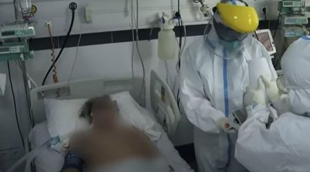 Bakıda çəkiliş zamanı koronaviruslu xəstənin vəziyyəti ağırlaşdı - VİDEO