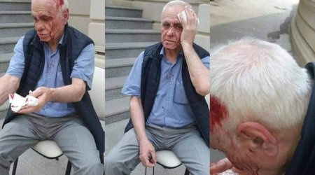 Bakıda keçmiş nazirə hücum: Başını yardılar - FOTO