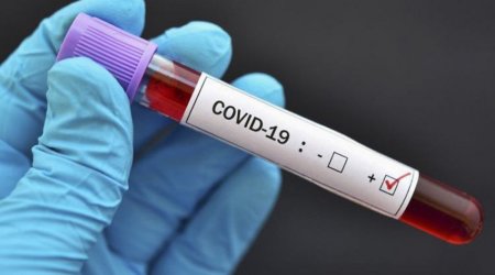 Gürcüstanda daha 3 333 nəfərdə COVID-19 aşkarlanıb, 56 nəfər ölüb