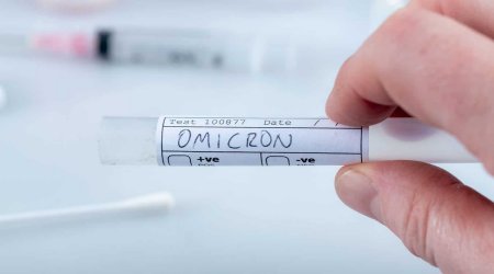 Omicron ştamı neçə ölkədə tapılıb? - ÜST-dən AÇIQLAMA