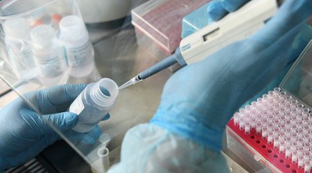 Gürcüstanda “Omicron”a yoluxanların sayı 144-ə çatdı