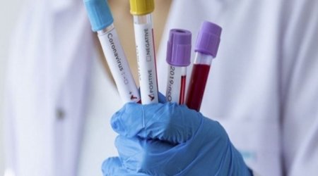 Rusiyada koronavirusa yoluxanların sayı 14 milyonu ötüb