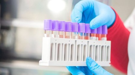 Rusiyada nazal peyvəndin kliniki sınaqları başladı