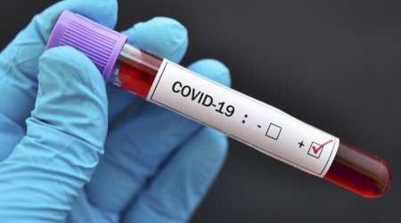 İranda son sutkada COVID-19-dan daha 154 nəfər ölüb