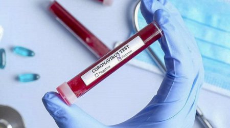 Rusiyada daha 14 355 nəfər koronavirusa yoluxub