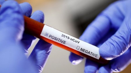 Rusiyada yoluxma artıb