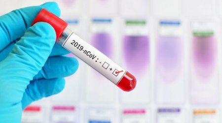 Azerbaijan confirms 15 new COVID-19 cases