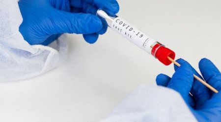 Bu ölkədə PCR testi ləğv edilir