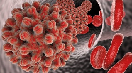 22 ölkədə naməlum mənşəli hepatit aşkarlanıb