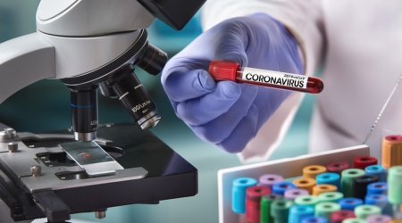 Azerbaijan reports 2 new coronavirus cases, no deaths