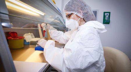 Almaniyada meymunçiçəyinə yoluxanlar karantinə alınacaq