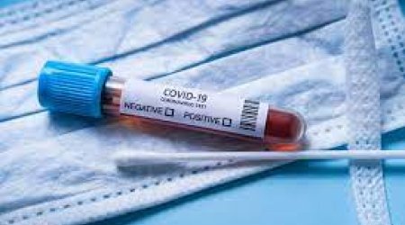 Dünyada son yeddi gündə 8,7 min insan COVID-19 səbəbilə ölüb