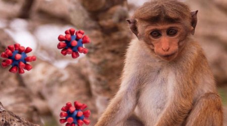 Meymunçiçəyi virusu Türkiyədə AŞKARLANDI