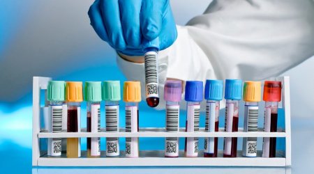 Koronavirusla bağlı dünyada son vəziyyət 