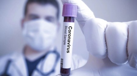 Azerbaijan reports 69 new COVID-19 cases