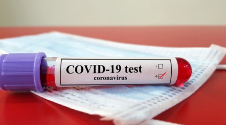 Azerbaijan confirms 155 new COVID-19 cases