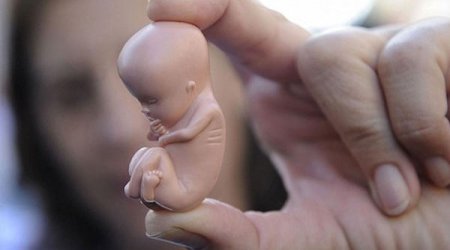 ABŞ-ın bu ştatında abort qadağan edildi