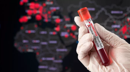 Meymunçiçəyi kişilər arasında çox yayılıb  - ÜST-ün mətbuat konfransından detallar