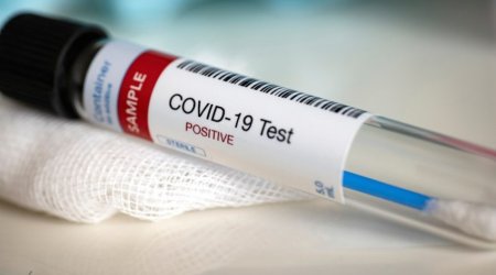 Azerbaijan reports 144 new COVID-19 cases, 8 deaths