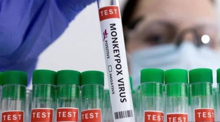 Rusiya meymunçiçəyinə qarşı vaksin hazırladı