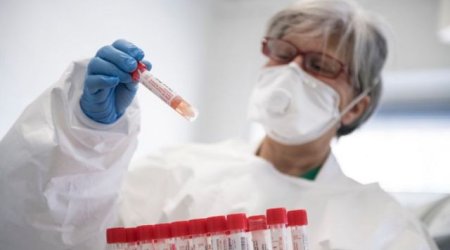 Dünyada koronavirusla bağlı son STATİSTİKA