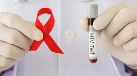 Spread of HIV localized in Azerbaijan