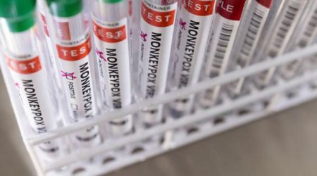 Şimali Kiprdə meymunçiçəyi aşkarlandıb