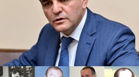 Azərbaycanda sui-qəsdə məruz qalan DEPUTATLAR