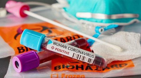 Azerbaijan confirms 62 new COVID-19 cases, 3 deaths