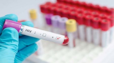 Qanada ötən il 9 mindən çox insan QİÇS-dən ölüb