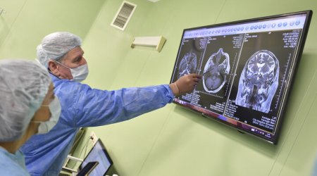 Alimlərin covidin insan beynini 20 ilə qədər geri saldığını araşdırıb